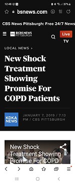 I had this treatment done five years ago, it was a clinical trial. They went in and shocked the mucus off my left lung.A month later, they shot the mucus off my right lung.